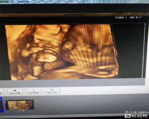 西安代生双胞胎医院:丙二醇对代孕妈妈有害吗